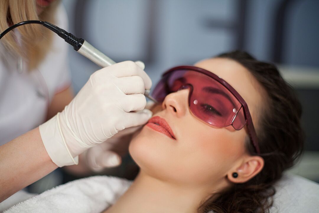 laser for skin rejuvenation