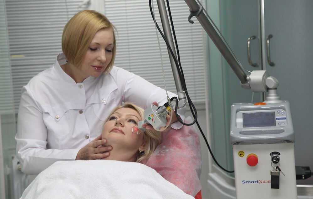 fractional laser skin resurfacing procedure