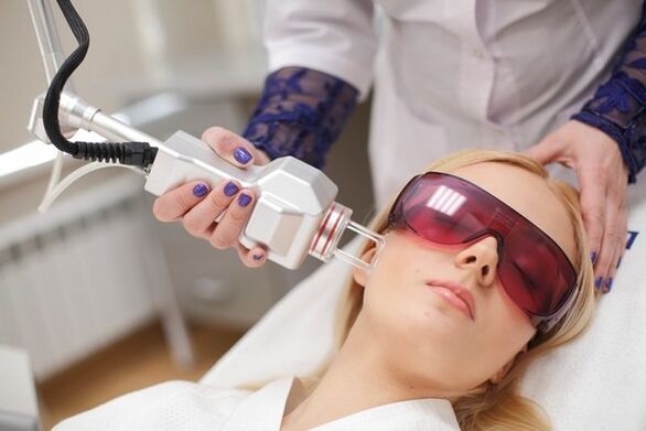 Face laser rejuvenation